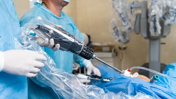 Лікування раку матки роботом Да Вінчі