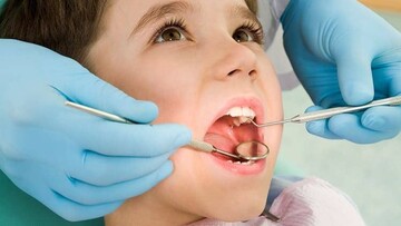 Що буде, якщо не лікувати карієс вчасно у дитини?